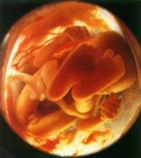 очень интересная статья с картинками.5-й месяц беременности