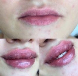 Губы, кто просил 👄 Губы, кто просил 👄