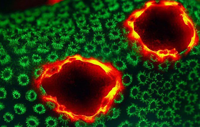 Конкурс микро-фотографий Nikon Small World 2011