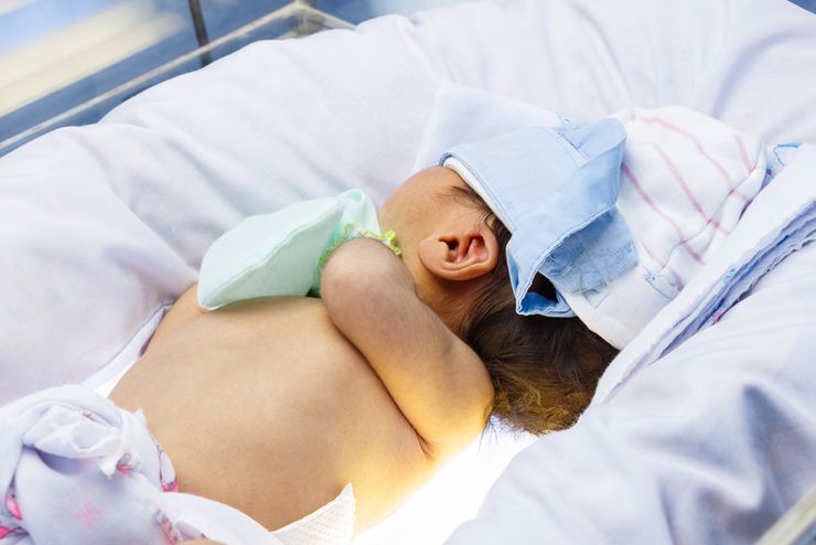 Формы геморрагической болезни новорожденных