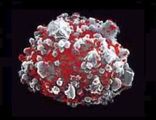 Клетка, пораженная ВИЧ
