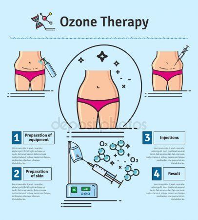 озонотерапия для похудения